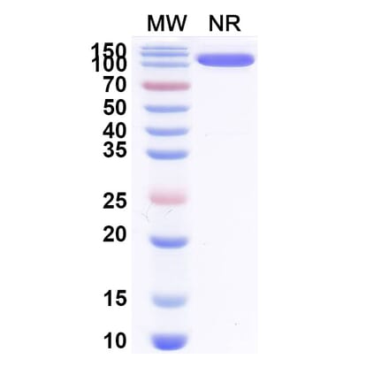 SDS-PAGE - Anti-Allergen Bet v I-A Nanobody [SAA0668] (A337665) - Antibodies.com
