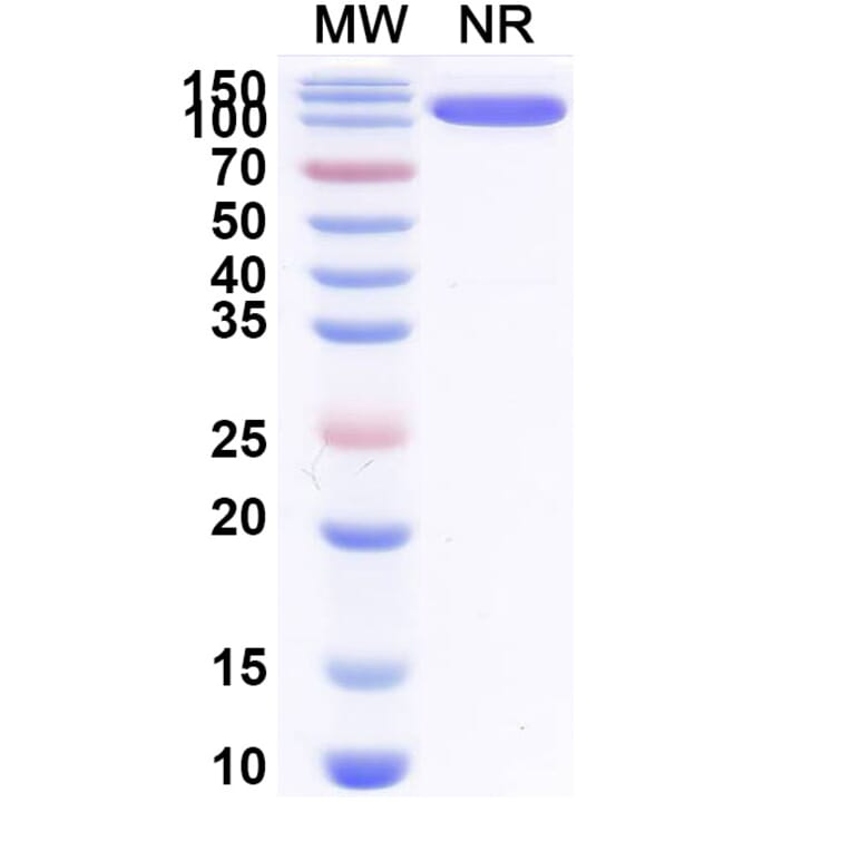 SDS-PAGE - Anti-Allergen Bet v I-A Nanobody [SAA0668] (A337665) - Antibodies.com