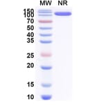 SDS-PAGE - Anti-Allergen Bet v I-A Nanobody [SAA0668] (A337665) - Antibodies.com