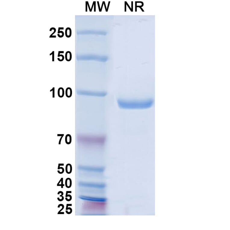 SDS-PAGE - Anti-A29L Nanobody [P1D4] (A337670) - Antibodies.com