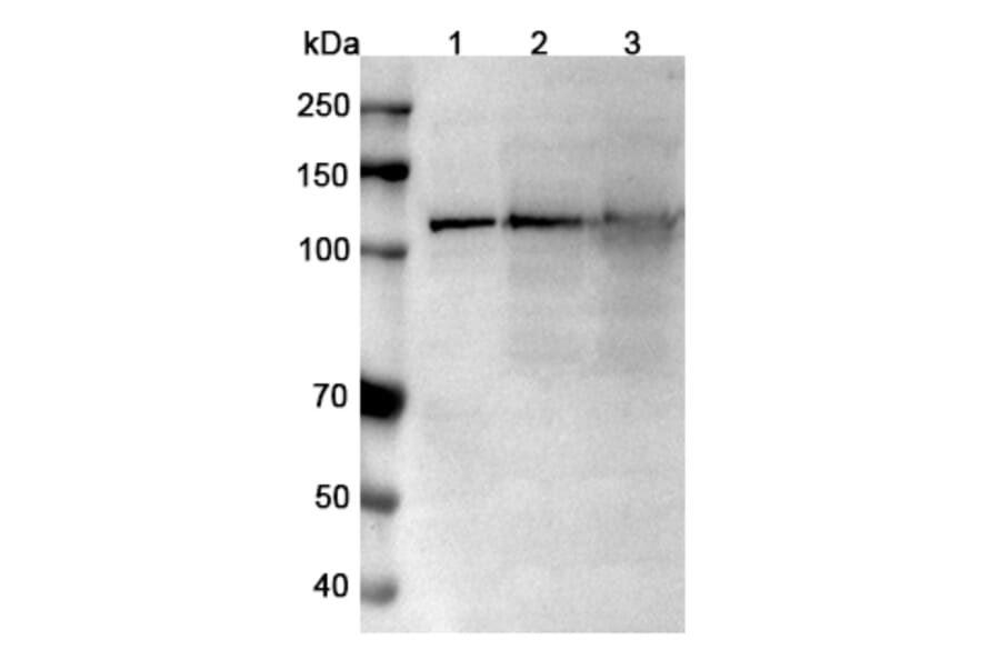 SDS-PAGE - Anti-TRPM4 Nanobody [SAA0760] (A337682) - Antibodies.com