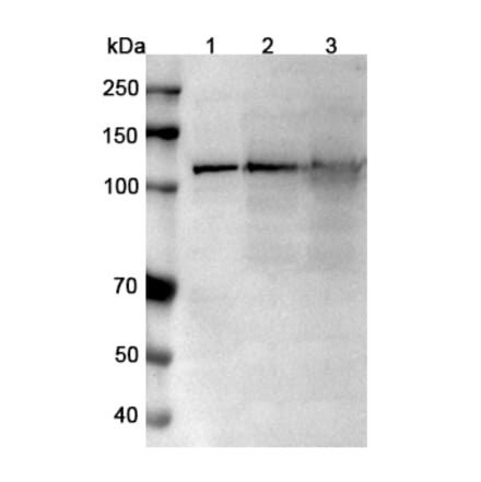 SDS-PAGE - Anti-TRPM4 Nanobody [SAA0760] (A337682) - Antibodies.com