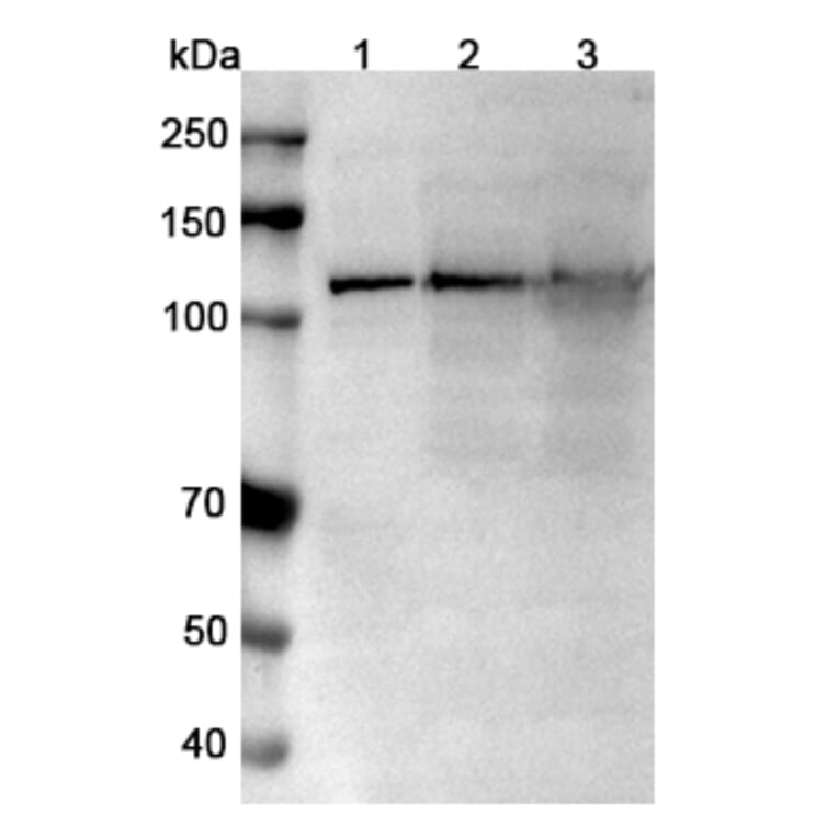 SDS-PAGE - Anti-TRPM4 Nanobody [SAA0760] (A337682) - Antibodies.com