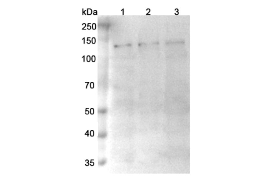 SDS-PAGE - Anti-TRPM4 Nanobody [SAA0760] (A337682) - Antibodies.com