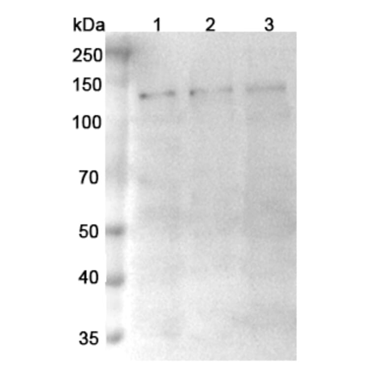 SDS-PAGE - Anti-TRPM4 Nanobody [SAA0760] (A337682) - Antibodies.com