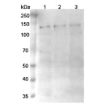 SDS-PAGE - Anti-TRPM4 Nanobody [SAA0760] (A337682) - Antibodies.com