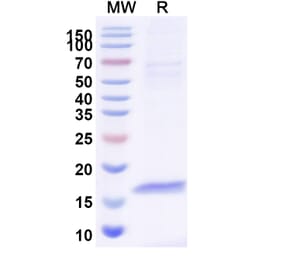 SDS-PAGE - Anti-CFTR Nanobody [SAA0794] (A337685) - Antibodies.com