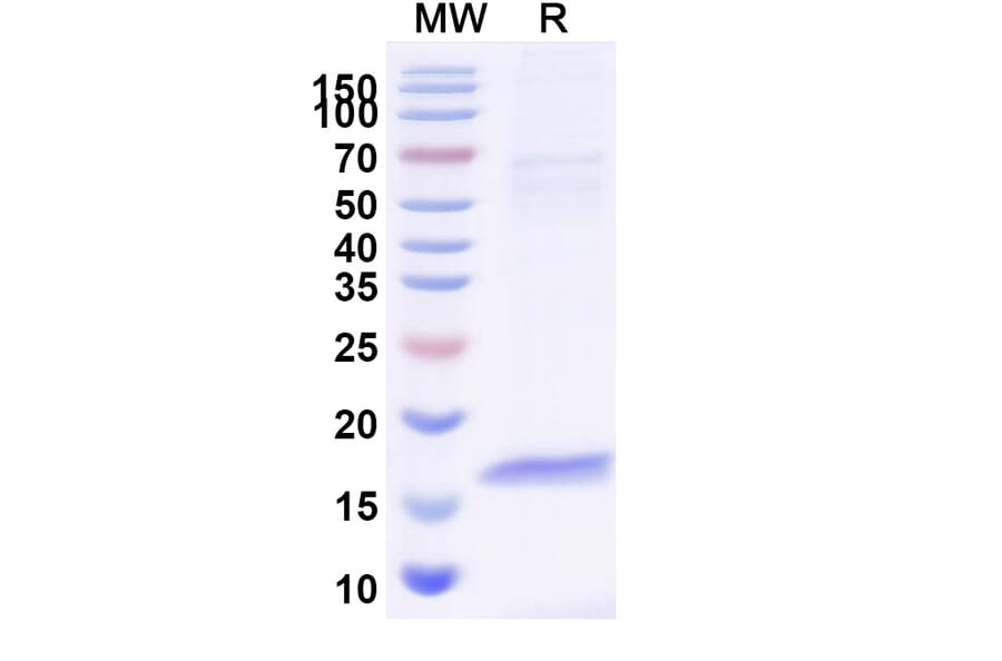 SDS-PAGE - Anti-CFTR Nanobody [SAA0794] (A337685) - Antibodies.com