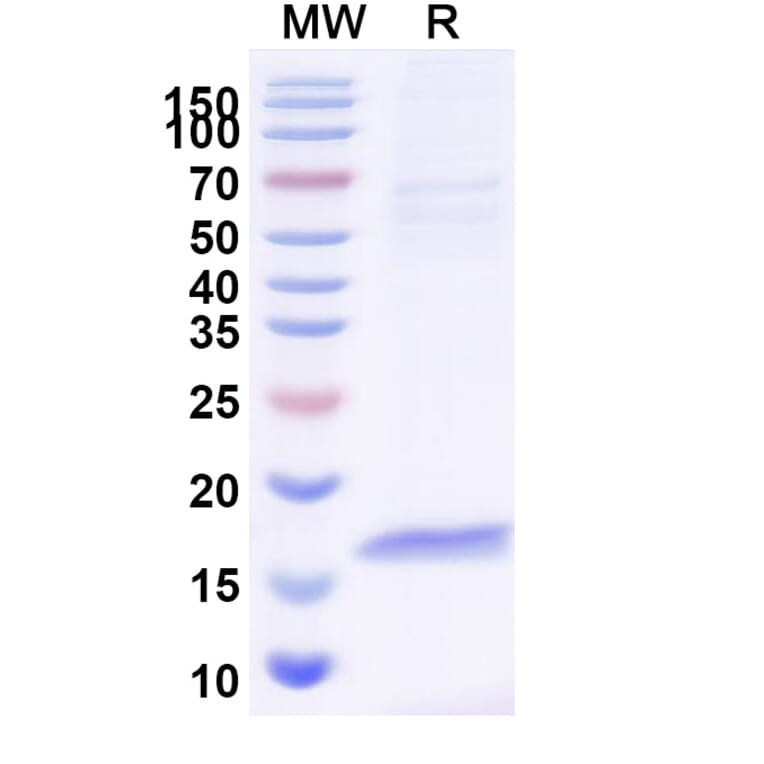 SDS-PAGE - Anti-CFTR Nanobody [SAA0794] (A337685) - Antibodies.com