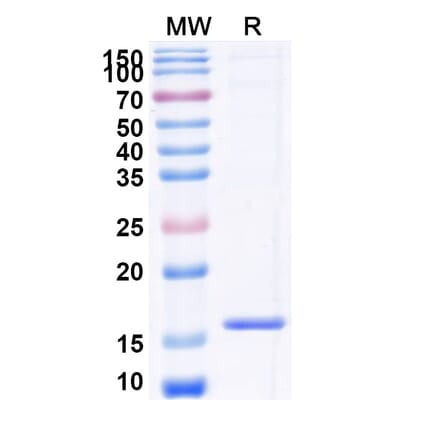 SDS-PAGE - Anti-CXCR7 Nanobody [SAA0795] (A337686) - Antibodies.com