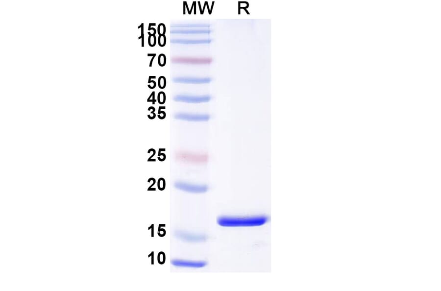 SDS-PAGE - Anti-PTH1R Nanobody [SAA0797] (A337688) - Antibodies.com