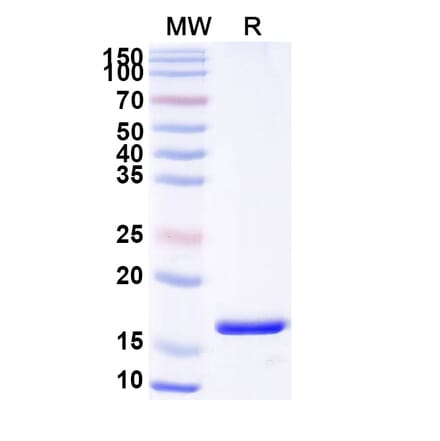 SDS-PAGE - Anti-PTH1R Nanobody [SAA0797] (A337688) - Antibodies.com