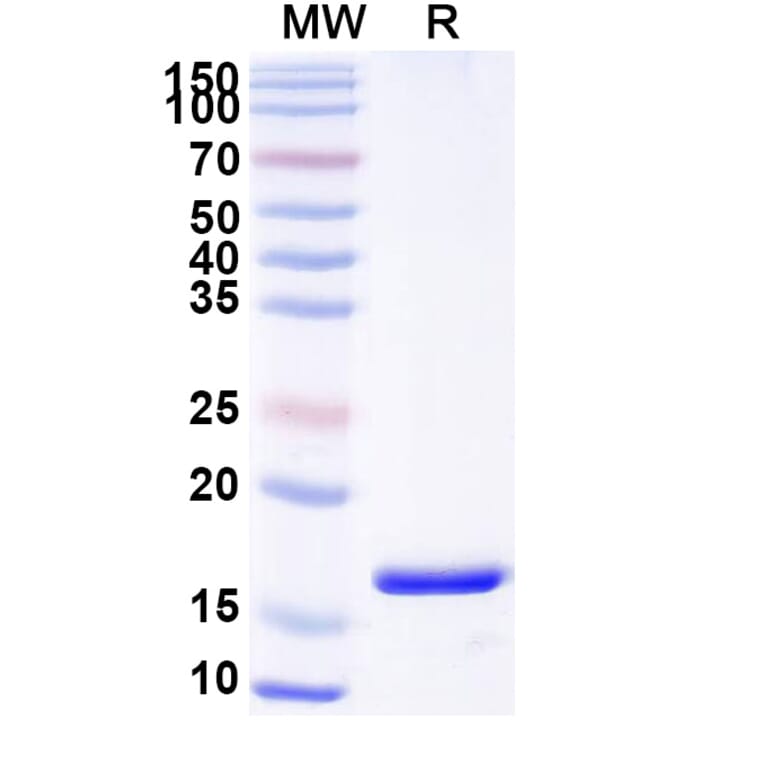 SDS-PAGE - Anti-PTH1R Nanobody [SAA0797] (A337688) - Antibodies.com