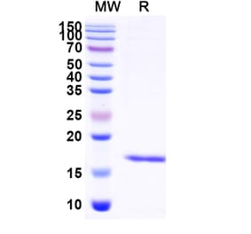 SDS-PAGE - Anti-Albumin Nanobody [SAA0807] (A337691) - Antibodies.com