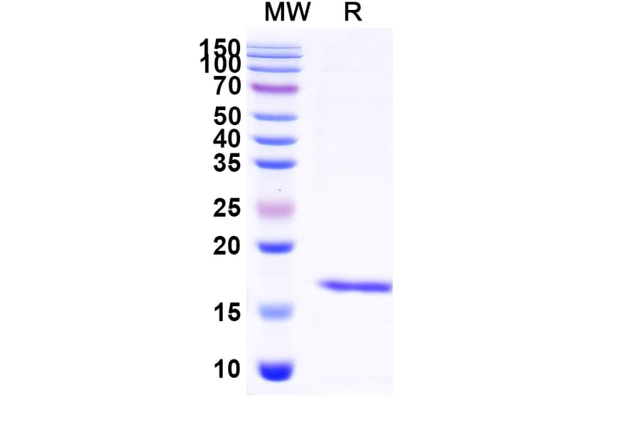SDS-PAGE - Anti-Albumin Nanobody [SAA0807] (A337691) - Antibodies.com