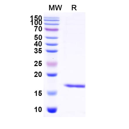 SDS-PAGE - Anti-Albumin Nanobody [SAA0807] (A337691) - Antibodies.com