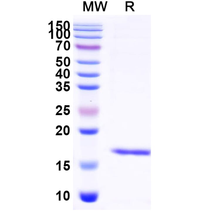 SDS-PAGE - Anti-Albumin Nanobody [SAA0807] (A337691) - Antibodies.com