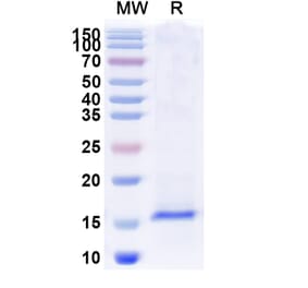 SDS-PAGE - Anti-TLR2 Nanobody [SAA0821] (A337693) - Antibodies.com