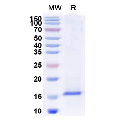 SDS-PAGE - Anti-TLR2 Nanobody [SAA0821] (A337693) - Antibodies.com