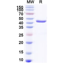 SDS-PAGE - Anti-Aflatoxin B1 Nanobody [Nb26] (A337694) - Antibodies.com