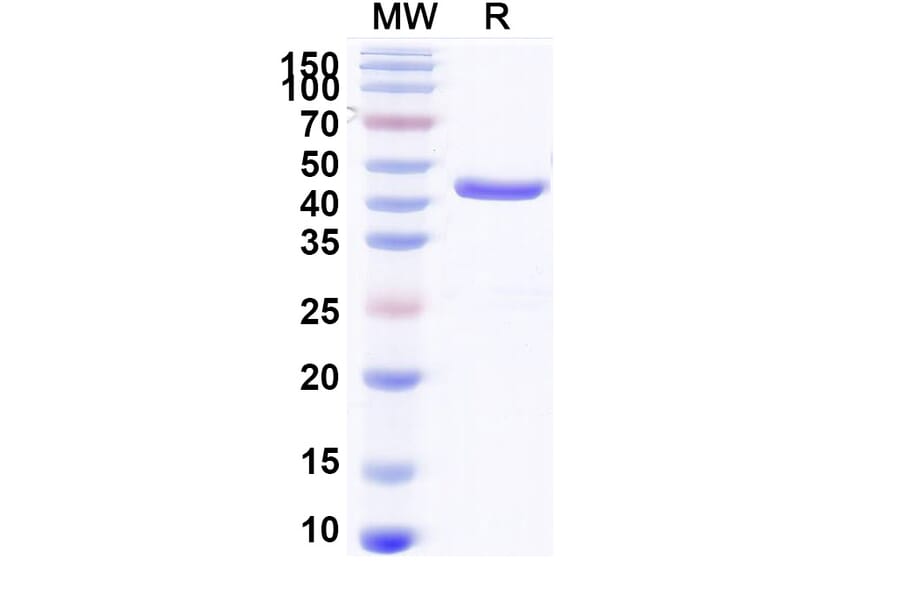 SDS-PAGE - Anti-Aflatoxin B1 Nanobody [Nb26] (A337694) - Antibodies.com
