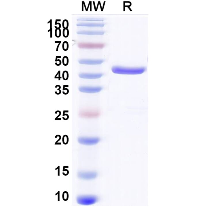 SDS-PAGE - Anti-Aflatoxin B1 Nanobody [Nb26] (A337694) - Antibodies.com
