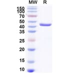 SDS-PAGE - Anti-Aflatoxin B1 Nanobody [Nb26] (A337694) - Antibodies.com