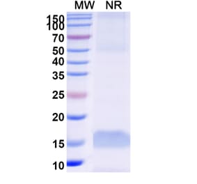 SDS-PAGE - Anti-MAGEB1 Nanobody [SAA0834] (A337695) - Antibodies.com