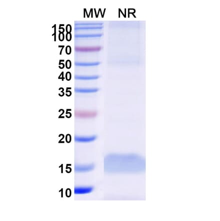 SDS-PAGE - Anti-MAGEB1 Nanobody [SAA0834] (A337695) - Antibodies.com