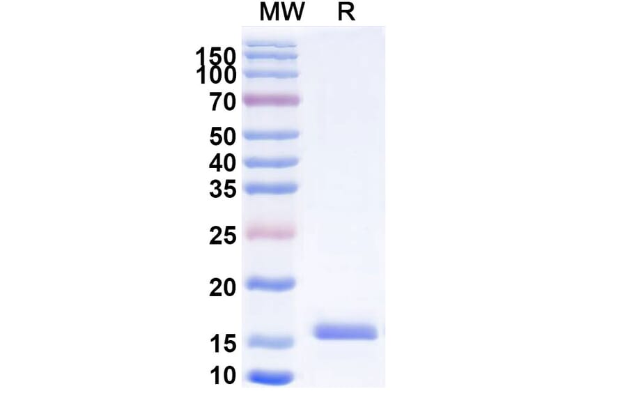 SDS-PAGE - Anti-CEA Nanobody [SAA0838] (A337698) - Antibodies.com