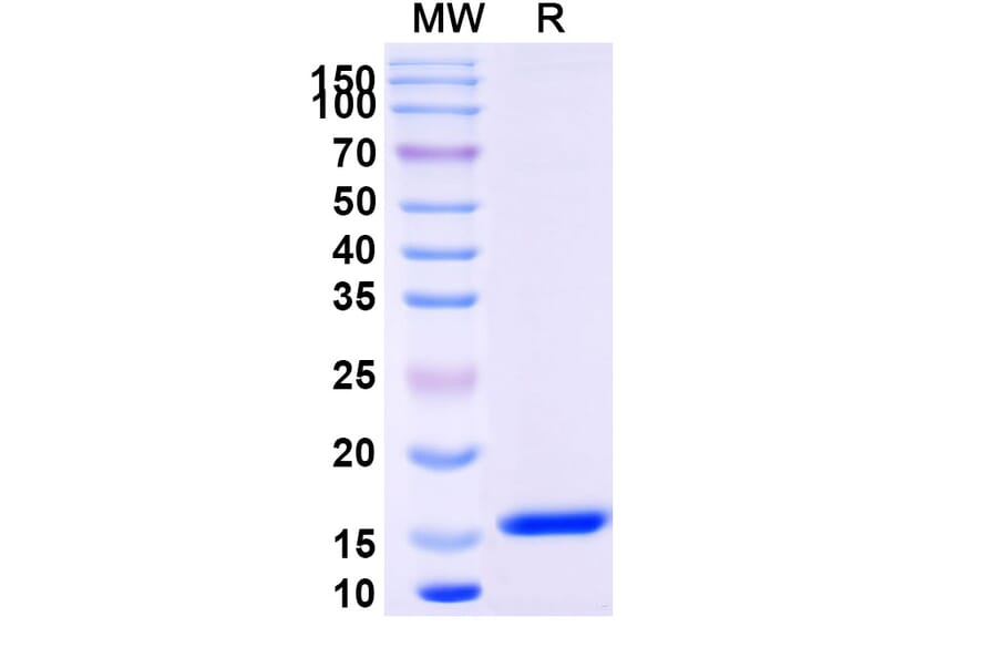SDS-PAGE - Anti-Lysozyme C Nanobody [SAA0887] (A337704) - Antibodies.com