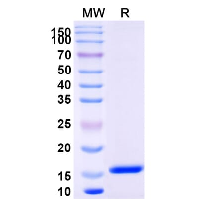 SDS-PAGE - Anti-Lysozyme C Nanobody [SAA0887] (A337704) - Antibodies.com