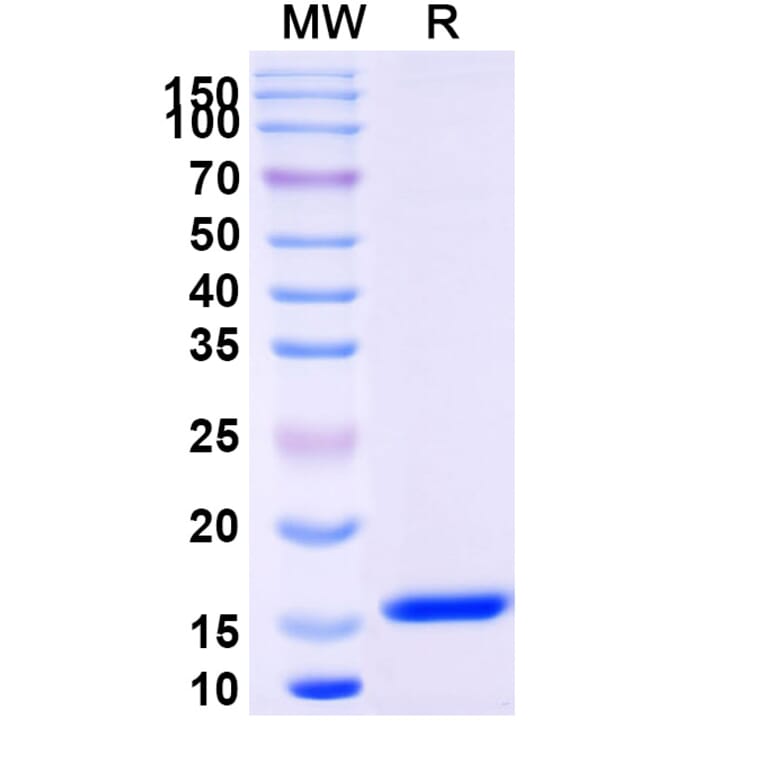 SDS-PAGE - Anti-Lysozyme C Nanobody [SAA0887] (A337704) - Antibodies.com