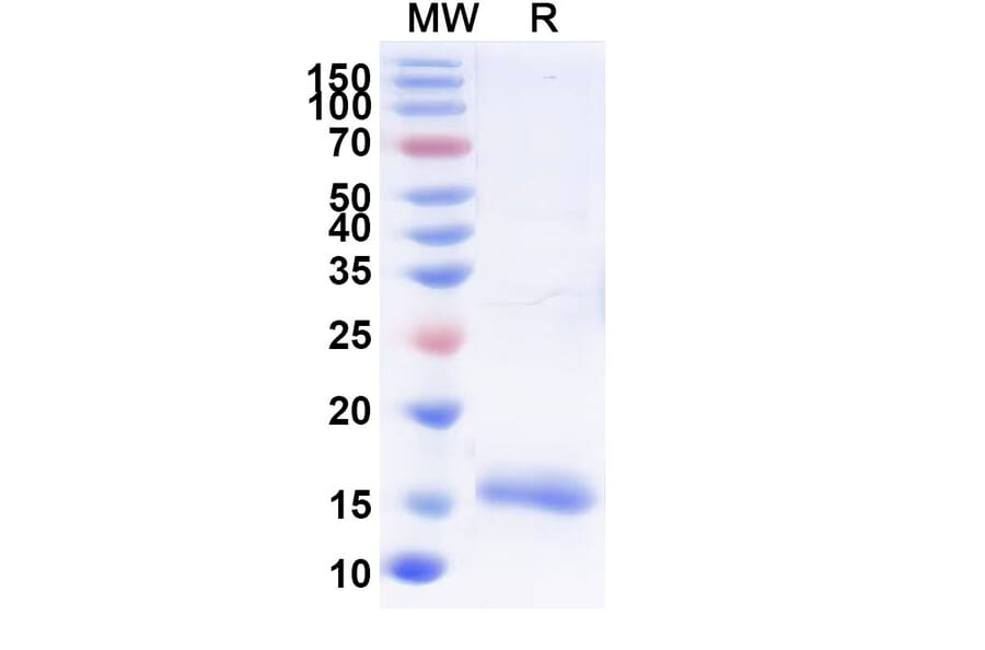 SDS-PAGE - Anti-Lysozyme C Nanobody [SAA0888] (A337705) - Antibodies.com
