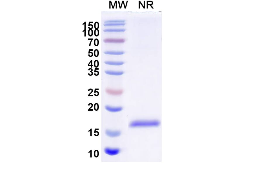 SDS-PAGE - Anti-Lysozyme C Nanobody [SAA0896] (A337706) - Antibodies.com