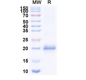 SDS-PAGE - Anti-Lysozyme C Nanobody [SAA0897] (A337707) - Antibodies.com
