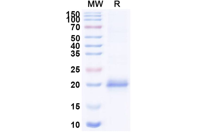 SDS-PAGE - Anti-Lysozyme C Nanobody [SAA0897] (A337707) - Antibodies.com