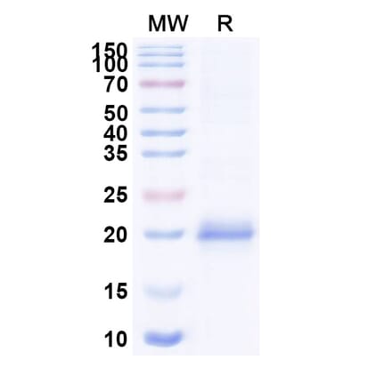 SDS-PAGE - Anti-Lysozyme C Nanobody [SAA0897] (A337707) - Antibodies.com