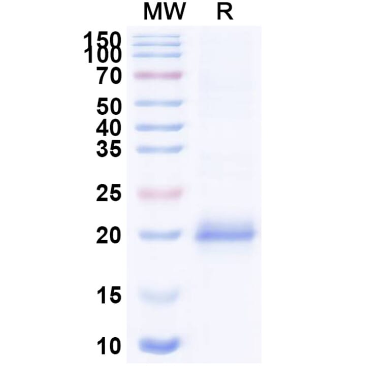 SDS-PAGE - Anti-Lysozyme C Nanobody [SAA0897] (A337707) - Antibodies.com