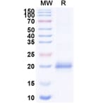 SDS-PAGE - Anti-Lysozyme C Nanobody [SAA0897] (A337707) - Antibodies.com