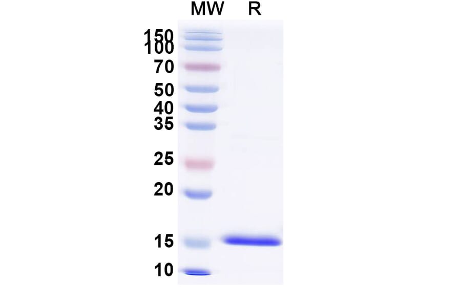 SDS-PAGE - Anti-Lysozyme C Nanobody [SAA0898] (A337708) - Antibodies.com