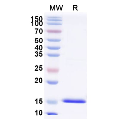 SDS-PAGE - Anti-Lysozyme C Nanobody [SAA0898] (A337708) - Antibodies.com