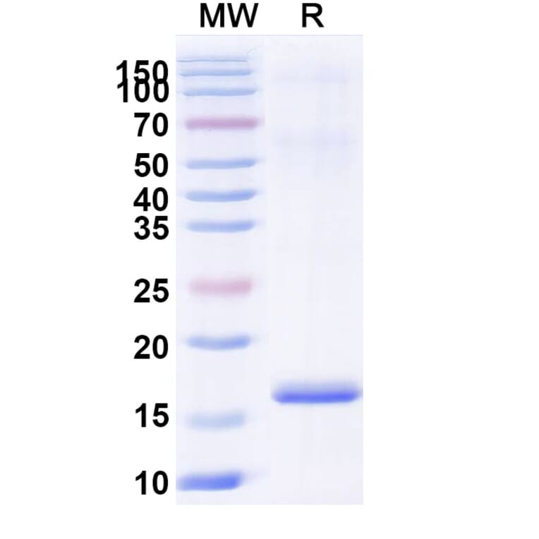 SDS-PAGE - Anti-Lysozyme C Nanobody [SAA0900] (A337709) - Antibodies.com