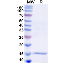 SDS-PAGE - Anti-Lysozyme C Nanobody [SAA1113] (A337710) - Antibodies.com