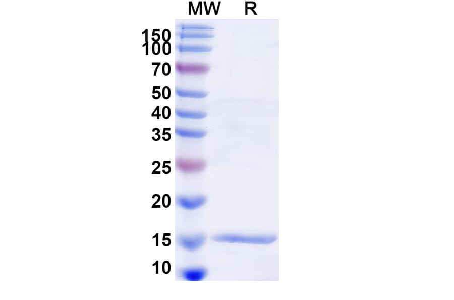 SDS-PAGE - Anti-Lysozyme C Nanobody [SAA1113] (A337710) - Antibodies.com