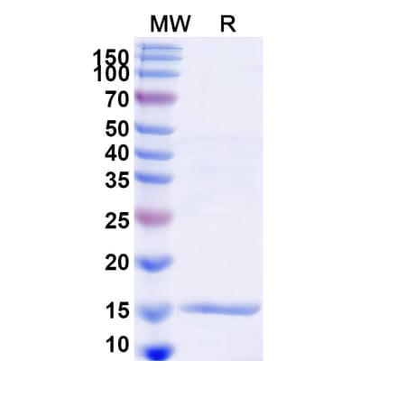 SDS-PAGE - Anti-Lysozyme C Nanobody [SAA1113] (A337710) - Antibodies.com