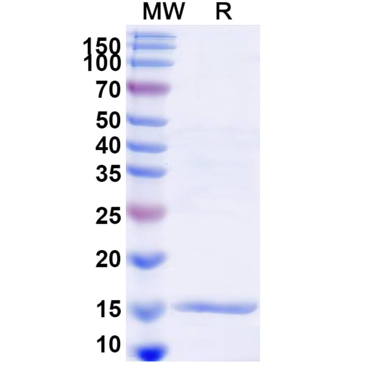 SDS-PAGE - Anti-Lysozyme C Nanobody [SAA1113] (A337710) - Antibodies.com