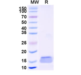 SDS-PAGE - Anti-TLR4 Nanobody [SAA1263] (A337714) - Antibodies.com