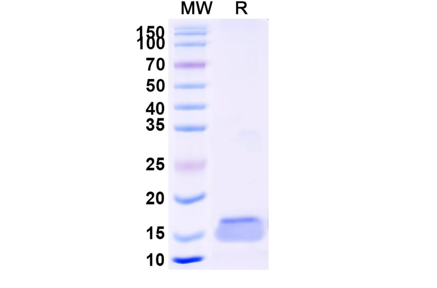 SDS-PAGE - Anti-TLR4 Nanobody [SAA1263] (A337714) - Antibodies.com