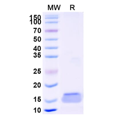SDS-PAGE - Anti-TLR4 Nanobody [SAA1263] (A337714) - Antibodies.com